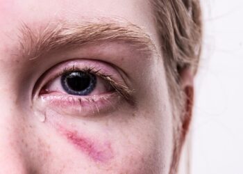 Psikolojik İşkence