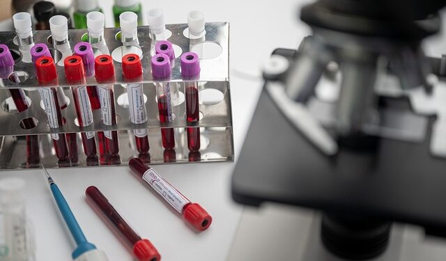 Mikrotom Çeşitleri Nelerdir