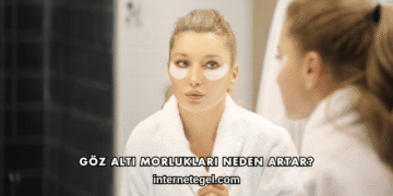 Göz Altı Morlukları Neden Artar?