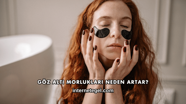 Göz Altı Morlukları Neden Artar?